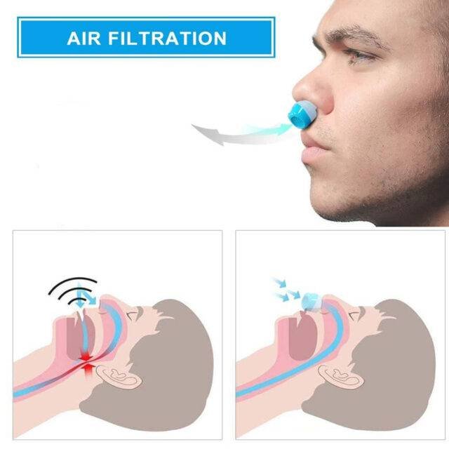 Anti Snoring Device