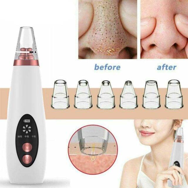 Blackhead Remover Vacuum