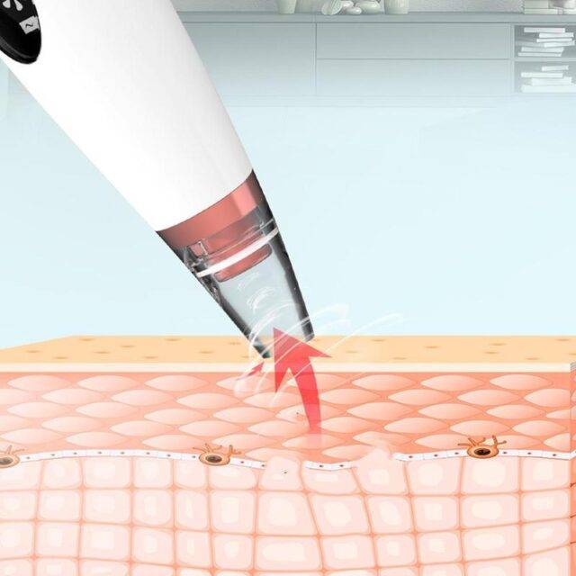 Blackhead Remover Vacuum