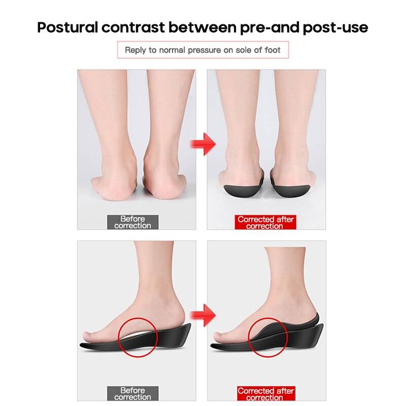 Arch Support For Flat Feet