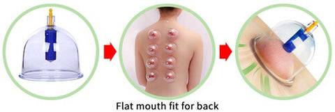 Cupping Therapy Set