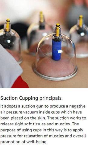 Cupping Therapy Set